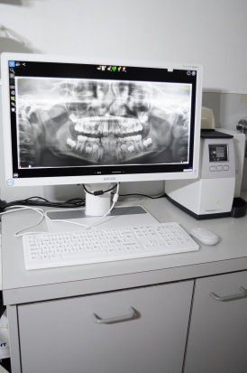 Digitales Röntgen